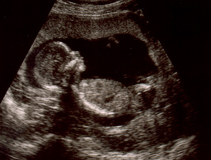 Baby : 4 bulan