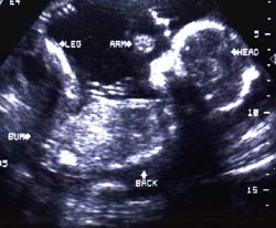 Baby : 5 bulan