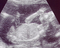 Baby : 6 bulan