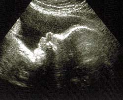 Baby : 8 bulan