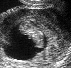 I'm 7 week's old